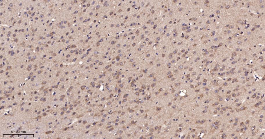 β-抑制蛋白1重组兔单抗-bsm-61185R