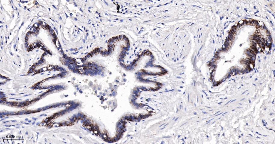 活化白细胞粘附分子重组兔单抗