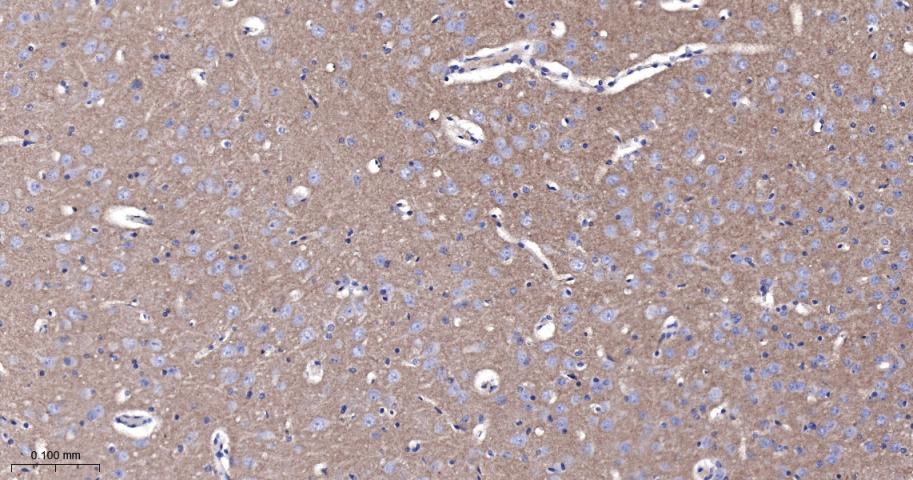 活化白细胞粘附分子重组兔单抗