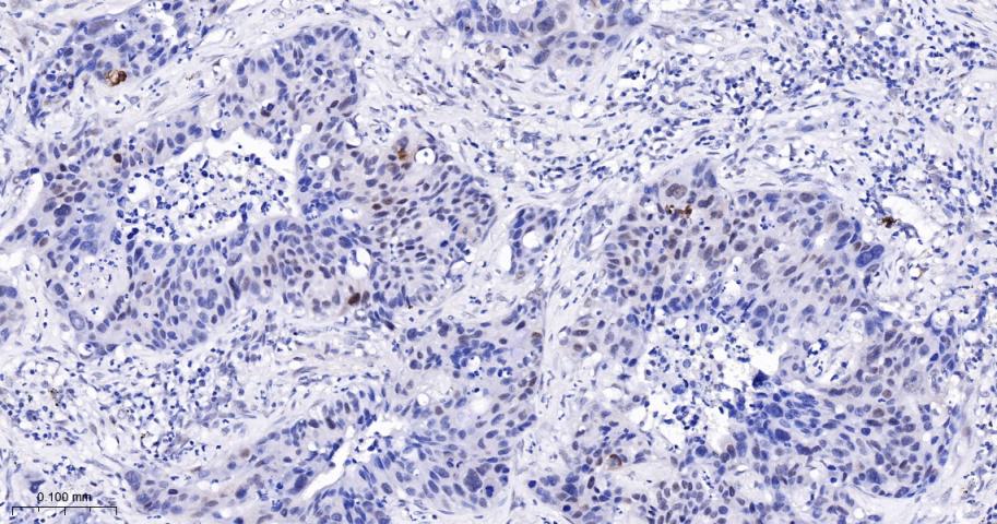 磷酸化PDZ连接激酶/T-LAK细胞源蛋白激酶重组兔单抗-bsm-62741R