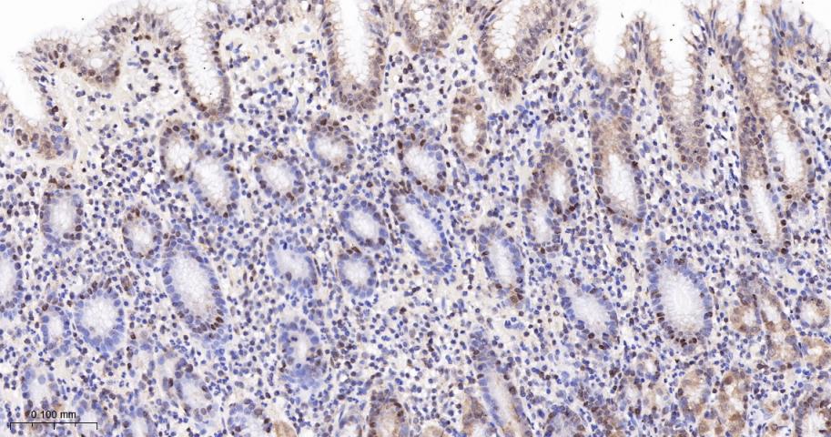 凋亡相关蛋白4重组兔单抗