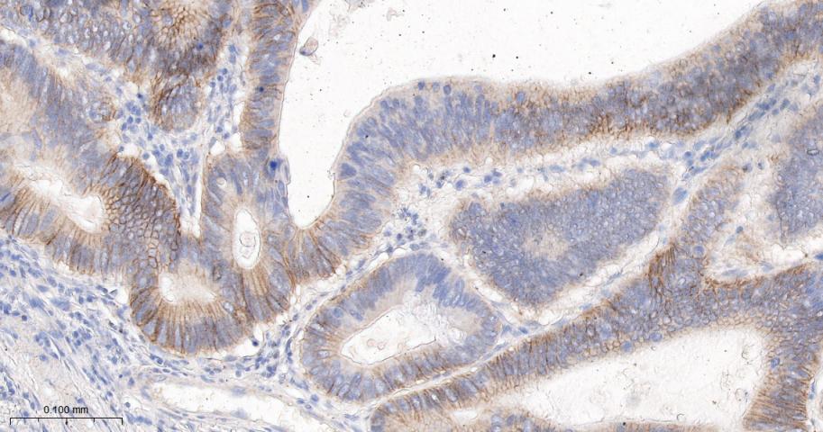 活化白细胞粘附分子重组兔单抗