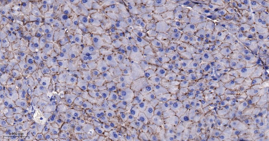 活化白细胞粘附分子重组兔单抗