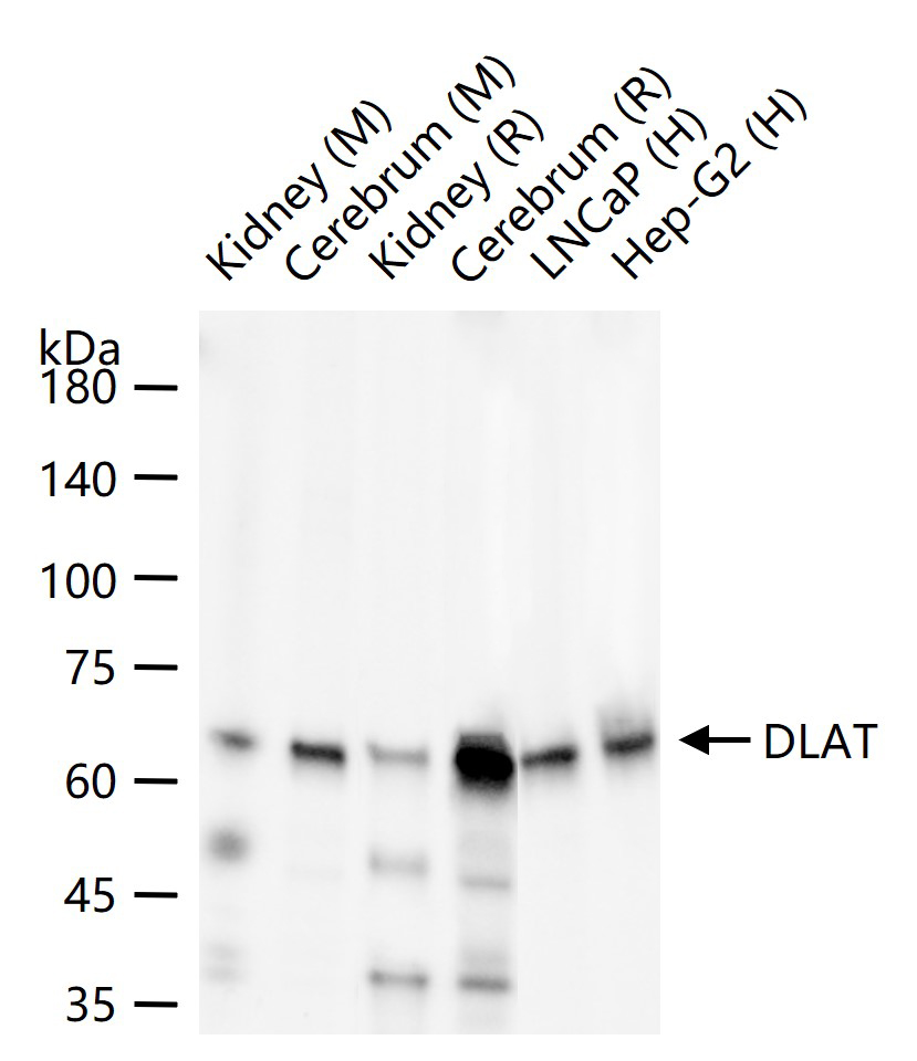 丙酮酸脱氢酶E2重组兔单抗