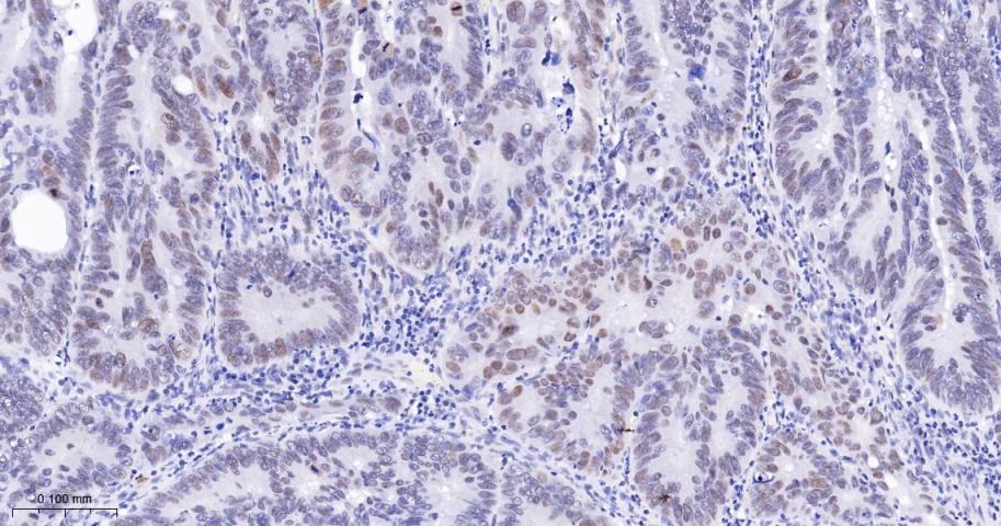 磷酸化PDZ连接激酶/T-LAK细胞源蛋白激酶重组兔单抗-bsm-62741R
