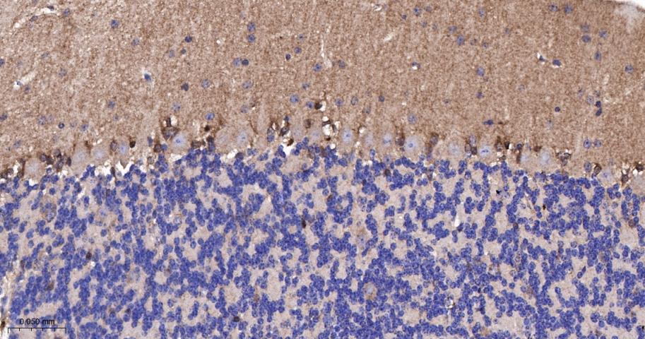 β-抑制蛋白1重组兔单抗-bsm-61185R