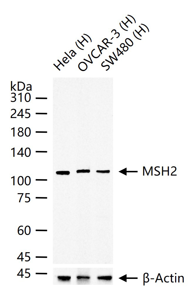 错配修复蛋白2重组兔单抗