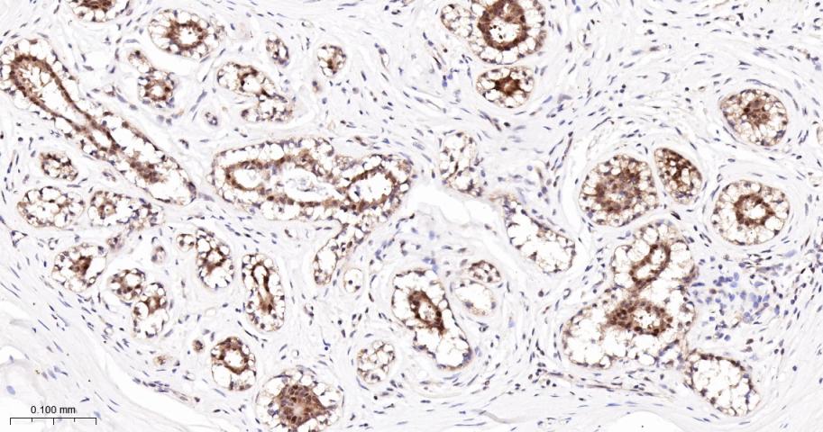 凋亡相关蛋白4重组兔单抗