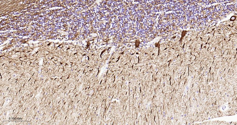 低分子量神经丝蛋白重组兔单抗