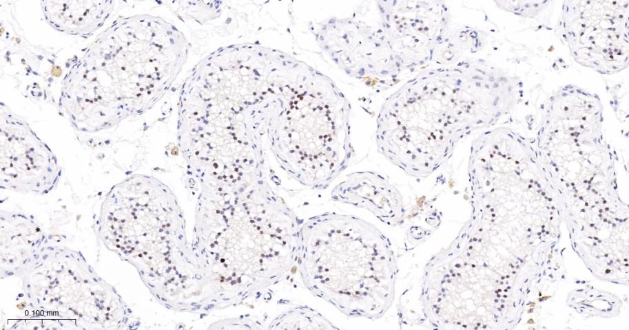 磷酸化PDZ连接激酶/T-LAK细胞源蛋白激酶重组兔单抗-bsm-62741R