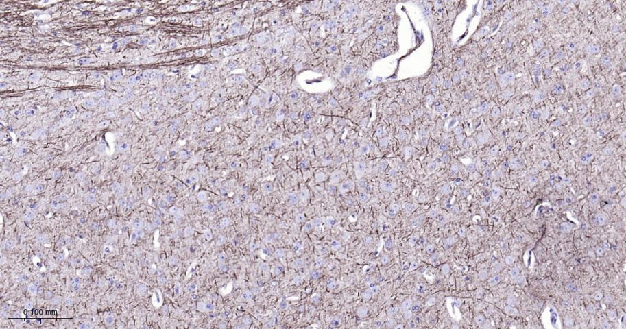 低分子量神经丝蛋白单克隆抗体-bsm-41217M
