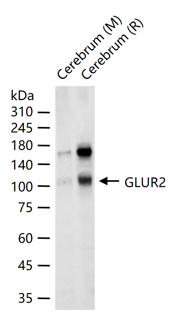 谷氨酸受体2重组兔单抗