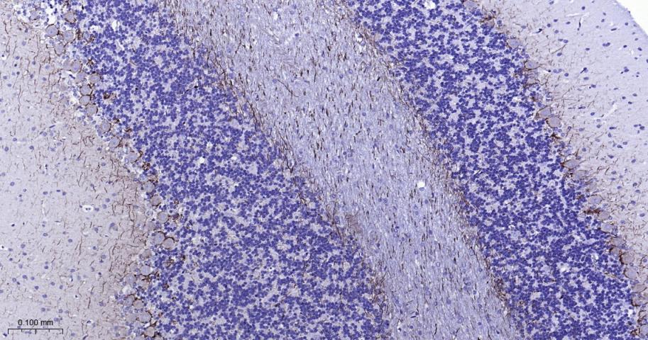 NF-L Mouse mAb (一抗) - IHC-P,IHC-F,IF | Bioss