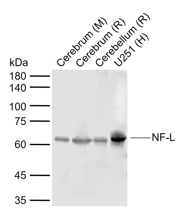 NF-L Rabbit pAb (一抗) - WB,IHC-P,IHC-F,IF,Flow-Cyt | Bioss