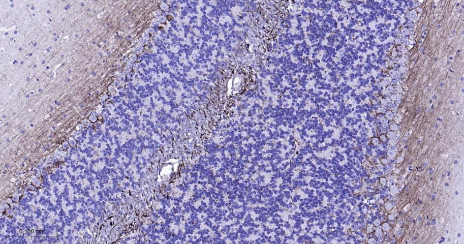 低分子量神经丝蛋白单克隆抗体-bsm-41217M