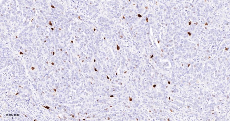 磷酸化核仁蛋白C23重组兔单抗-bsm-62916R