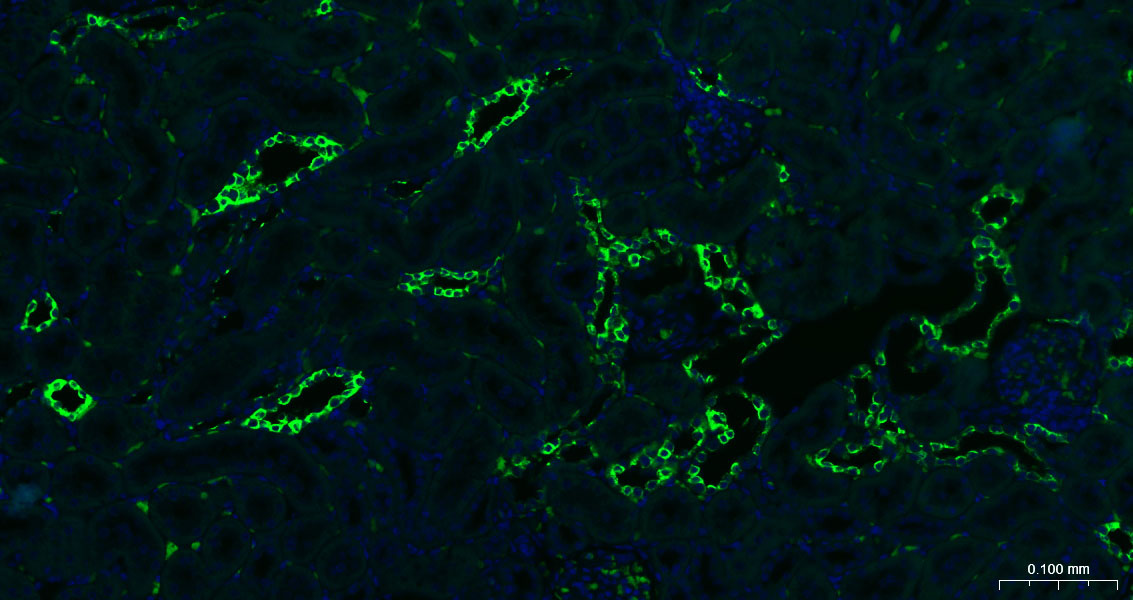 细胞角蛋白7重组兔单抗
