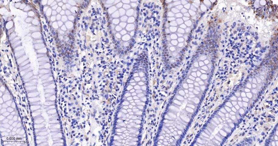 转录因子E2F-4重组兔单抗