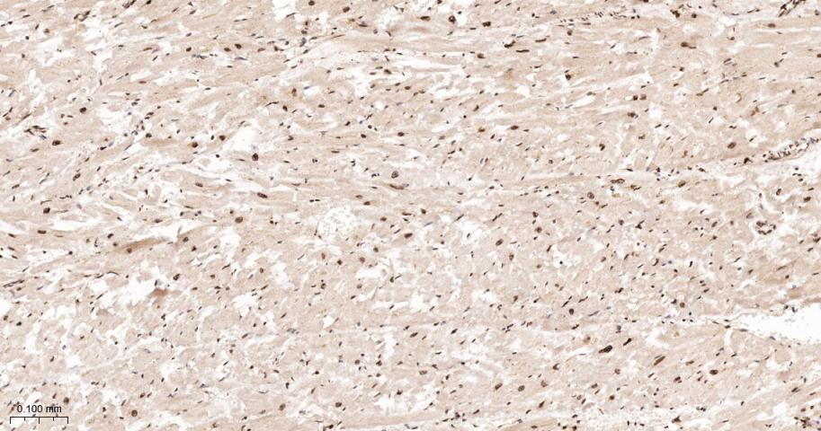 细胞内氯离子通道蛋白4重组兔单抗