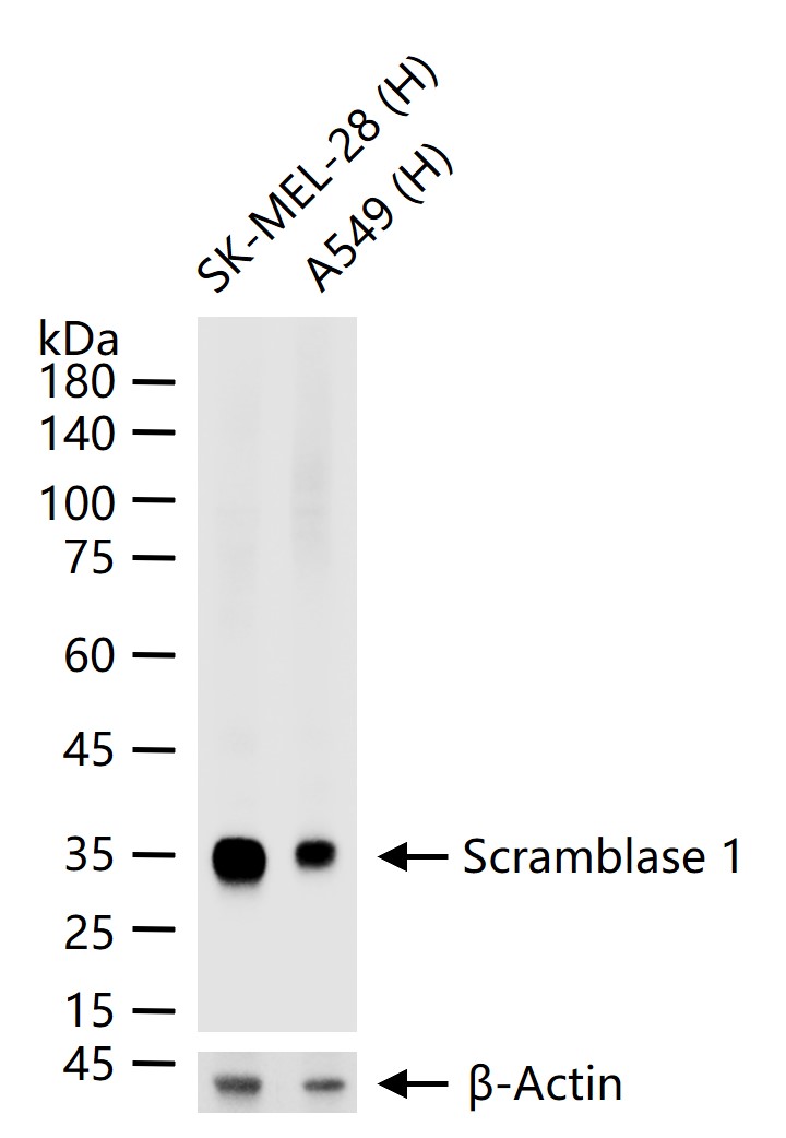 磷脂争夺酶1重组兔单抗