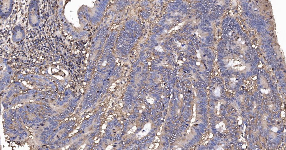 β-肌动蛋白/β-Actin(内参)抗体