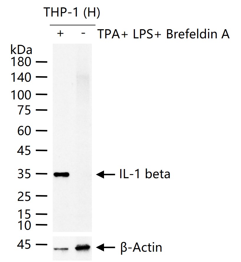 IL-1 beta Rabbit pAb (一抗) - WB | Bioss