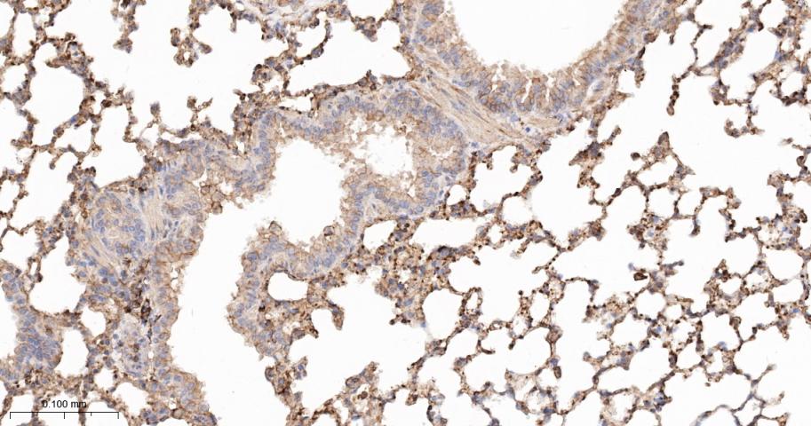 β-肌动蛋白/β-Actin(内参)抗体