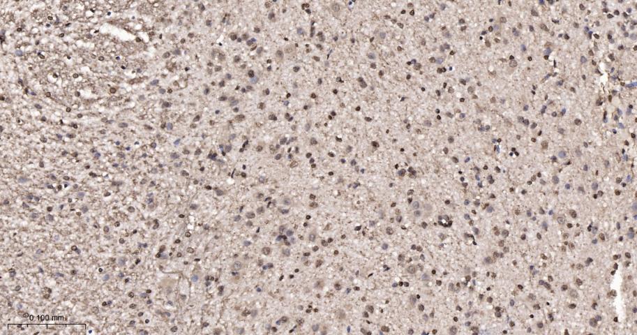 细胞内氯离子通道蛋白4重组兔单抗