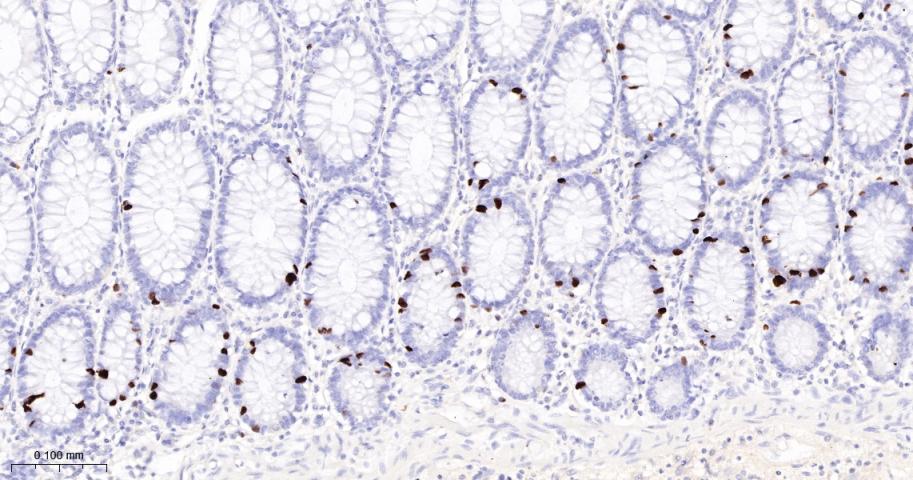 磷酸化核仁蛋白C23重组兔单抗-bsm-62916R