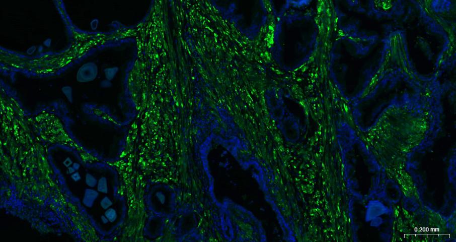 钙调节蛋白-1重组兔单克隆抗体