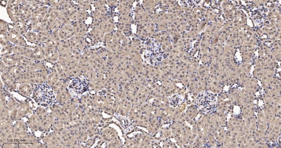 细胞内氯离子通道蛋白4重组兔单抗