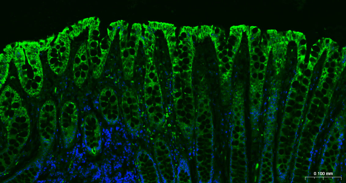 广谱细胞角蛋白PCK单克隆抗体