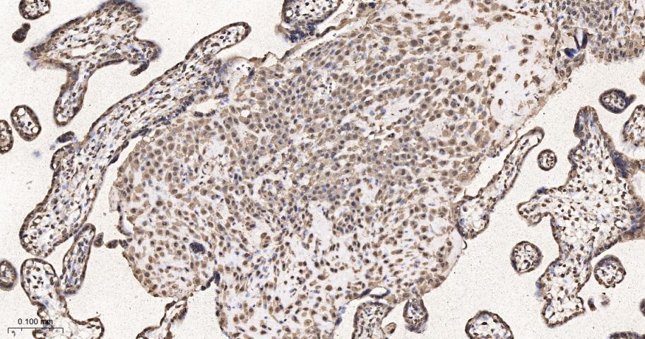 细胞内氯离子通道蛋白4重组兔单抗
