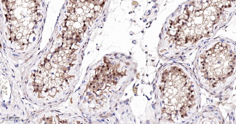 降钙素基因相关肽受体CRCP重组兔单抗-bsm-62756R