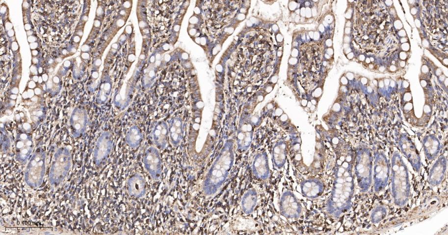 β-肌动蛋白/β-Actin(内参)抗体