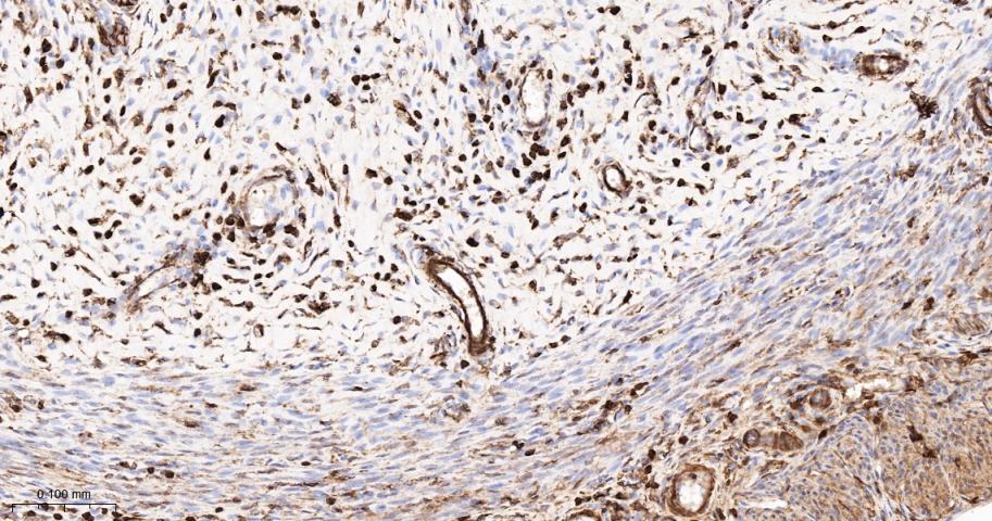 β-肌动蛋白/β-Actin(内参)抗体