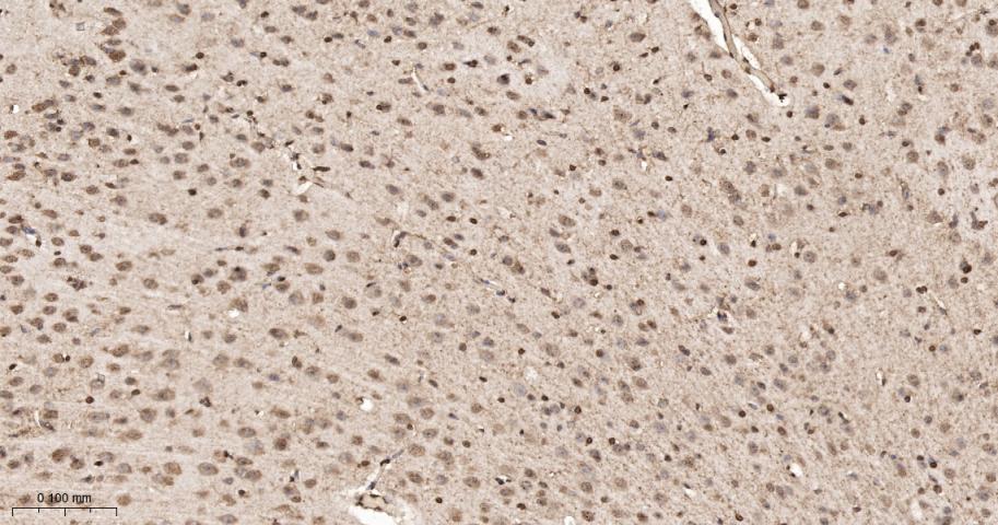 细胞内氯离子通道蛋白4重组兔单抗