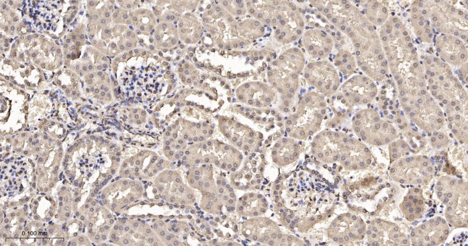 细胞内氯离子通道蛋白4重组兔单抗