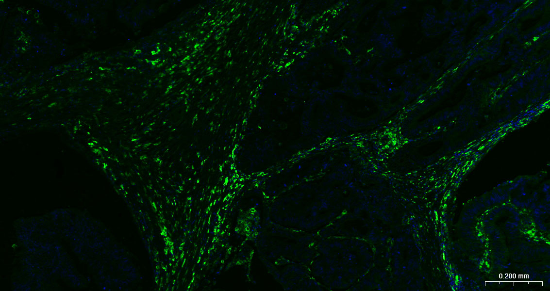 CD163重组兔单抗