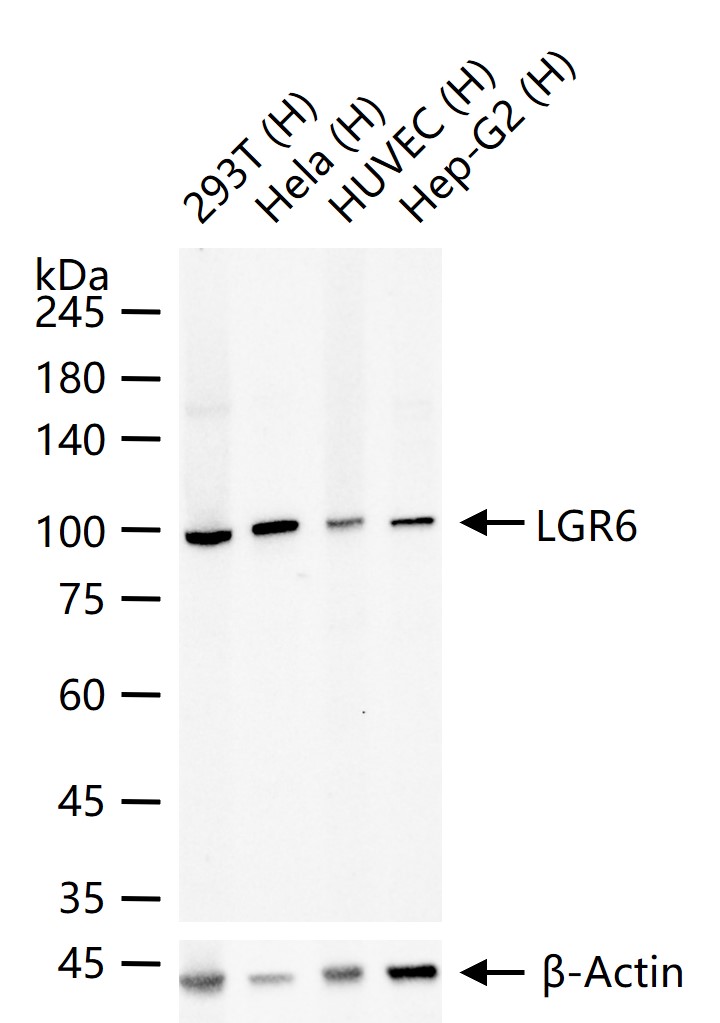 G蛋白偶联受体6重组兔单抗