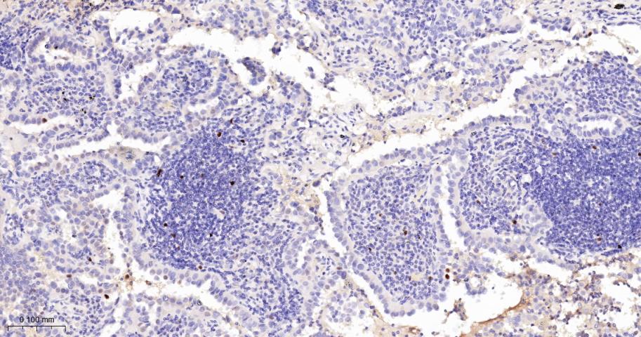 磷酸化核仁蛋白C23重组兔单抗-bsm-62916R