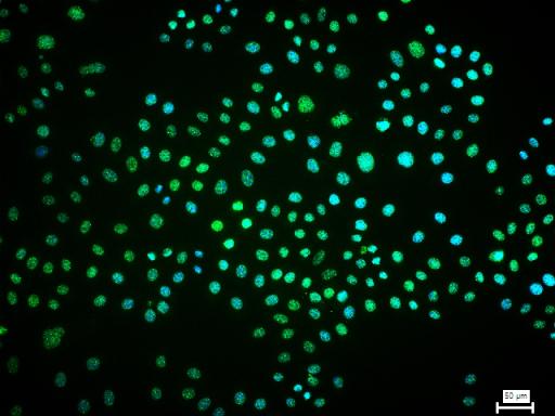 类泛素蛋白1重组兔单抗