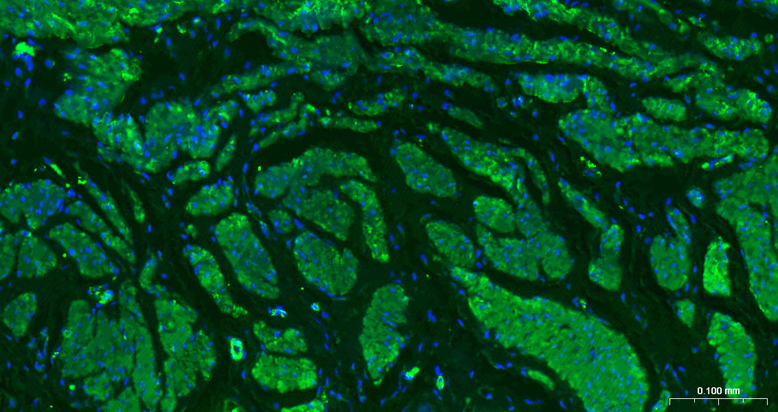 结蛋白单克隆抗体-bsm-33229M