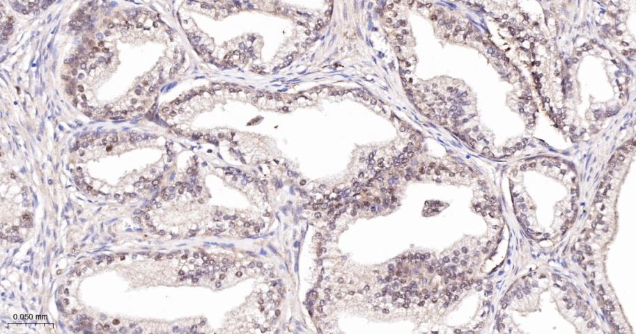 降钙素基因相关肽受体CRCP重组兔单抗-bsm-62756R