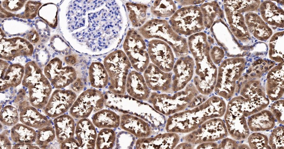 降钙素基因相关肽受体CRCP重组兔单抗-bsm-62756R