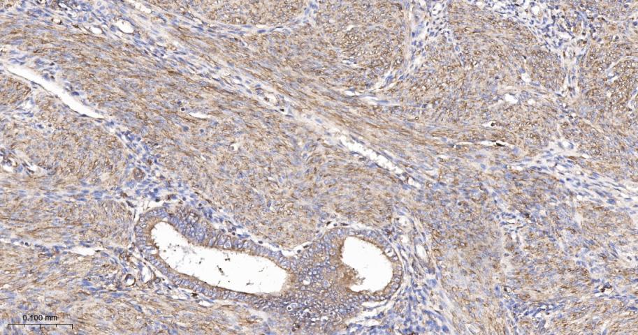 β-肌动蛋白/β-Actin(内参)抗体