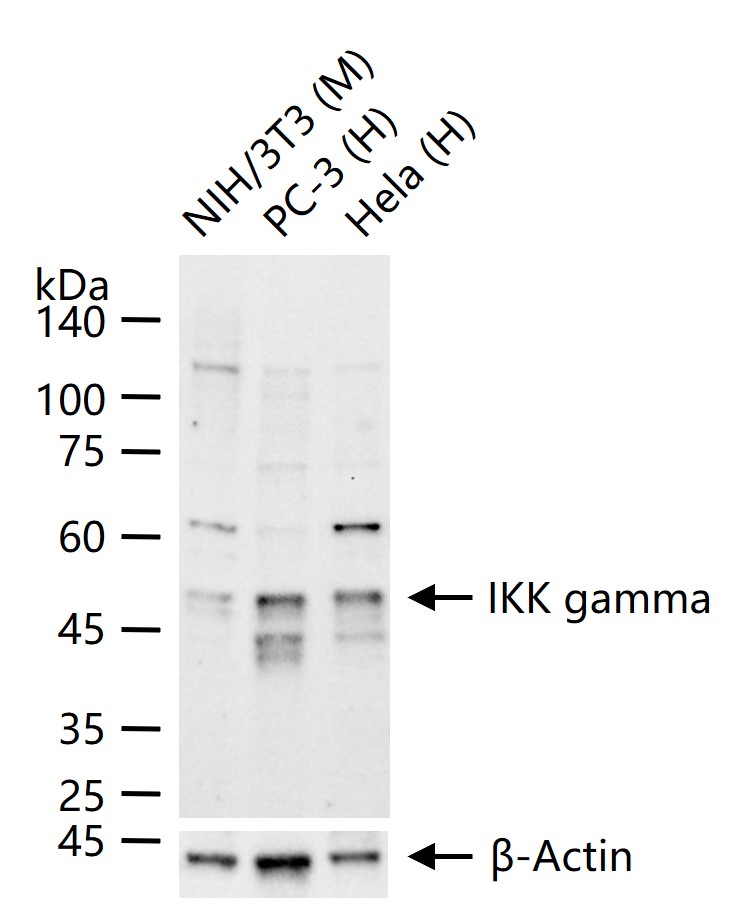 KB抑制蛋白激酶γ重组兔单抗