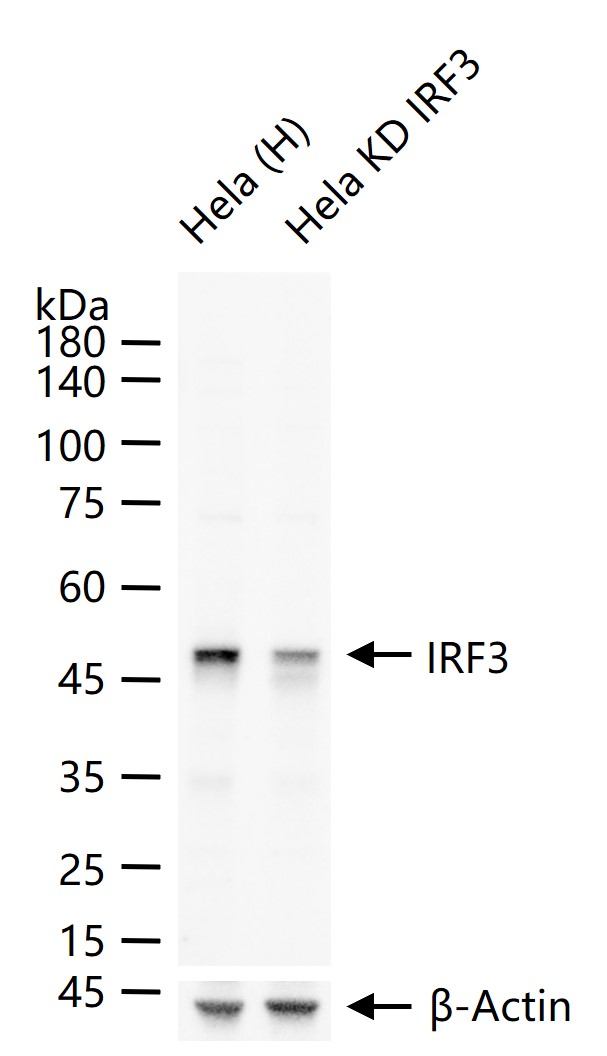 干扰素调节因子3重组兔单抗