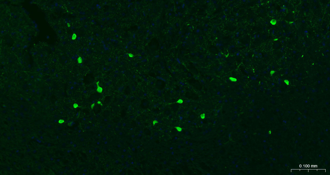 钙结合蛋白重组兔单抗