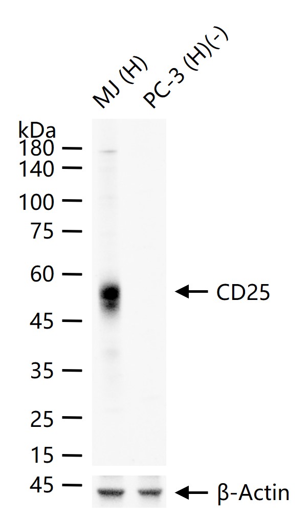 白介素2受体a链/ICD25重组兔单抗